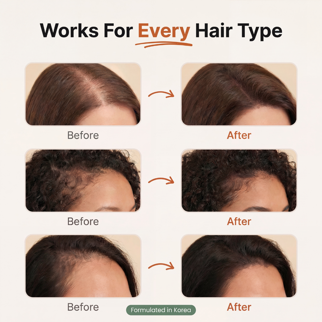 Reduce Shedding & Thinning Hair at the Root Powered by Korean Hair Science