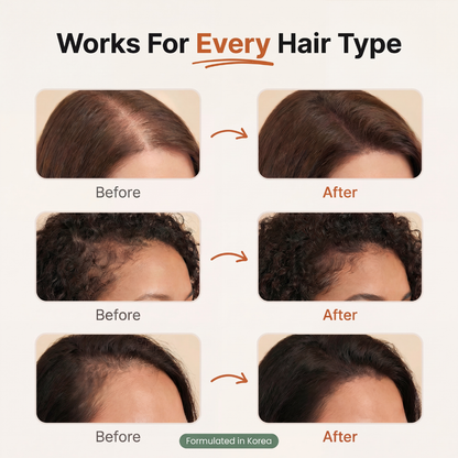 Reduce Shedding & Thinning Hair at the Root Powered by Korean Hair Science