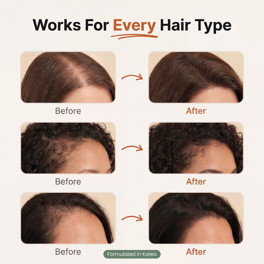 Korean Hair Growth Serum for Thinning Hair & Shedding
