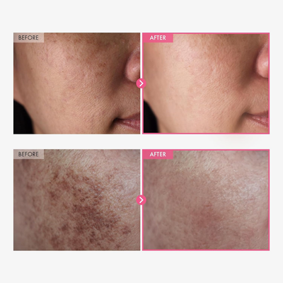 Sokosa Original Korean Brightening Cream VIP