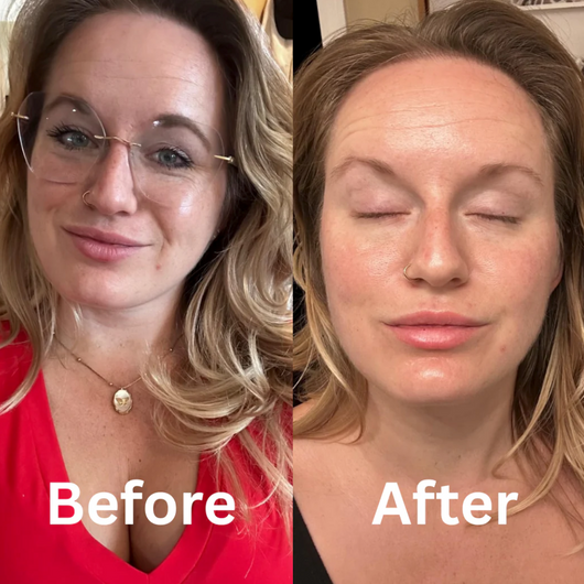 Bio Collagen Mask