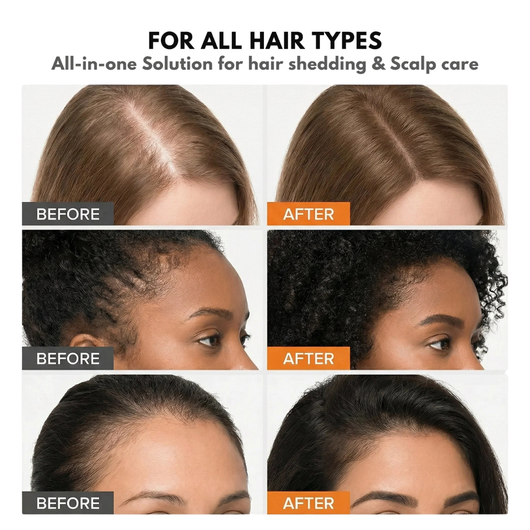 Korean Hair Growth Serum for Thinning Hair & Shedding