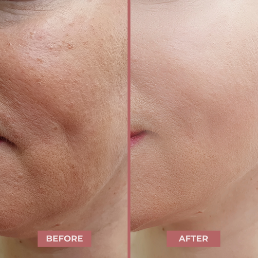 BioLift NAD+ Peptide Serum