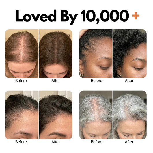 Korean Hair Growth Serum for Thinning Hair & Shedding