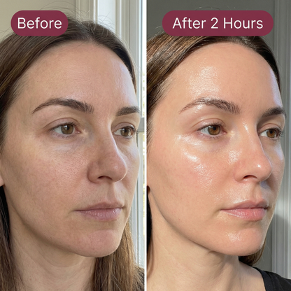Sokosa™ Snail 96 Mucin Mask