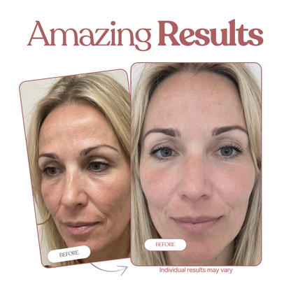 Sokosa Dermetra Calcium Multi Balm