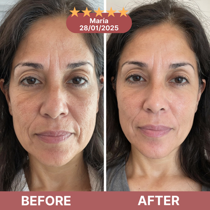 Sokosa Dermetra Calcium Multi Balm