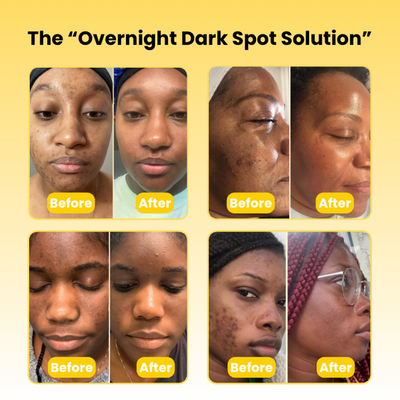 Kojic Acid Turmeric Wrapping Mask
