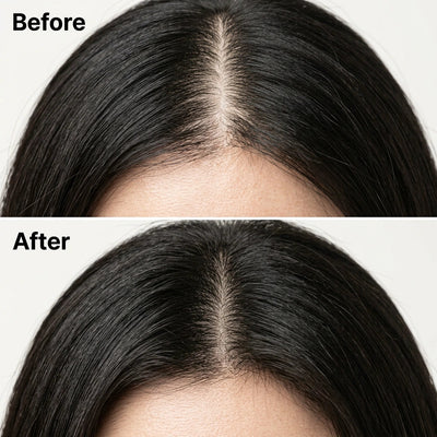 Korean Scalp Revive Bar