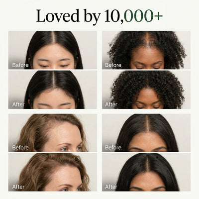 Korean Scalp Revive Bar